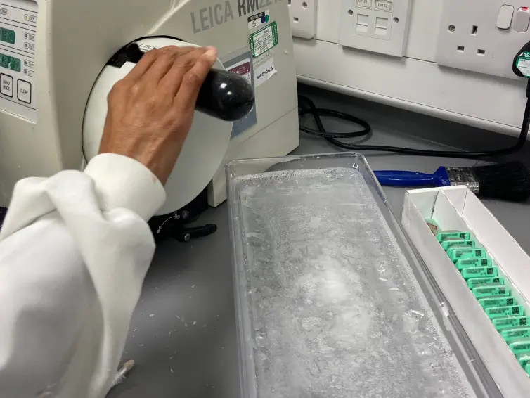 A microtome machine and Zaida's hand on the handle.
